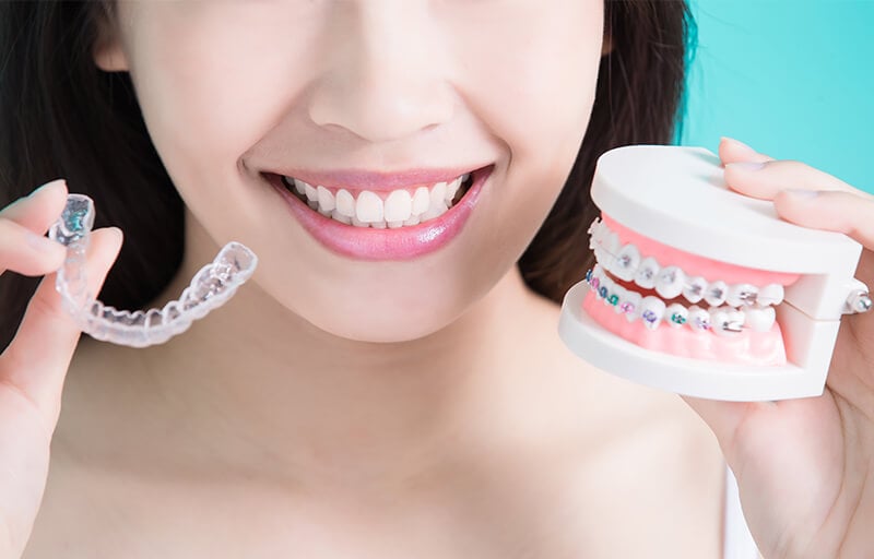 An aligner, a mouth, and some braces