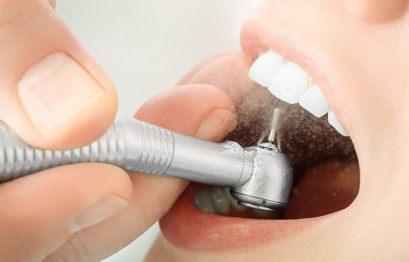 A dentist drill entering a mouth