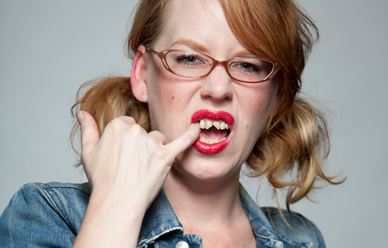 Woman with cracked and chipped front teeth