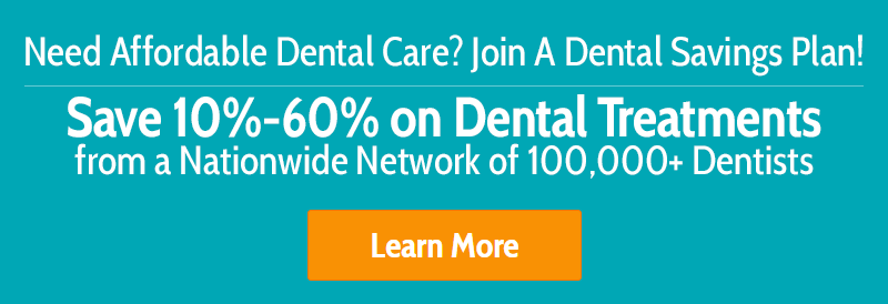 Need Affordable Dental Care? Join A Dental Savings Plan!